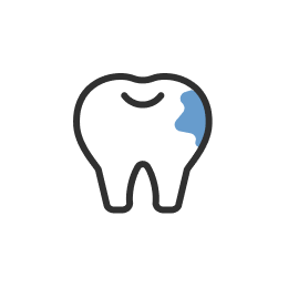 虫歯治療